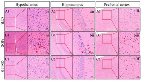 Suppressive Effects of Gelsemine on Anxiety-like Behaviors Induced by ...