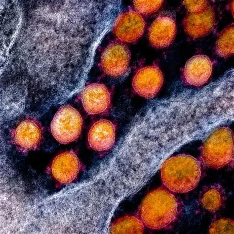 需警惕!多个研究团队发现,发生D614G突变的新冠病毒,感染人类细胞的能力或提高9倍-科技前沿-泓信生物——汇聚有生命力的未来