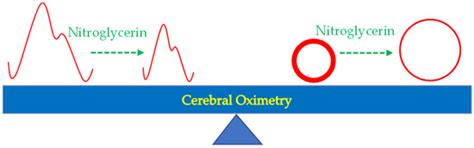 Cerebral Oximetry-Monitored Nitroglycerin Infusion and Tissue Perfusion ...