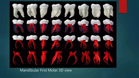 Mandibular first molar pulp canal morphology | PPTX