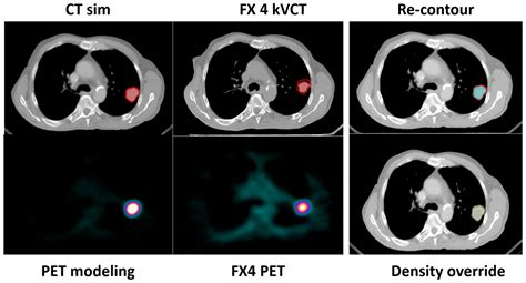 Strategies for Offline Adaptive Biology-Guided Radiotherapy (BgRT) on a ...