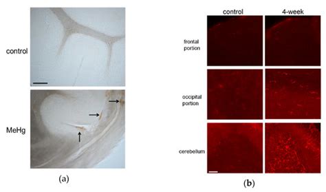 Vascular Dysfunction Induced by Mercury Exposure
