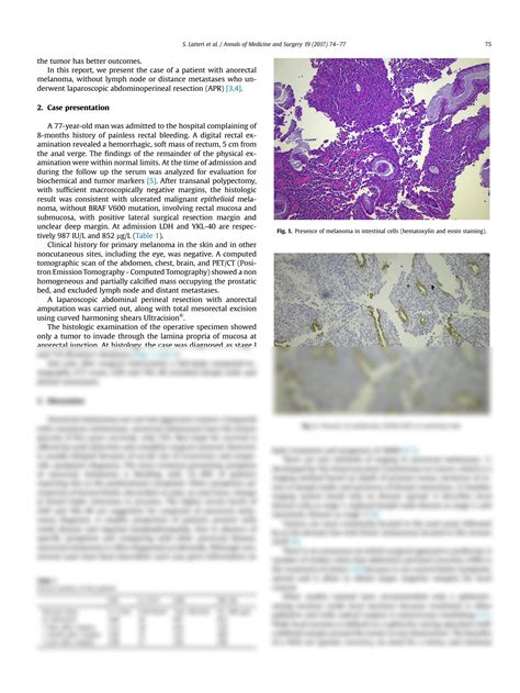 SOLUTION: Abdominal perineal resection or wilde local excision in primary anorectal malignant ...