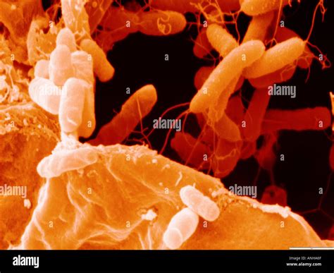 Agrobacteria Tumefaciens