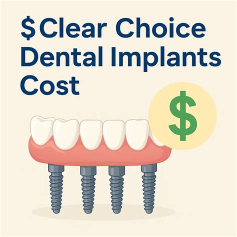 Clear Choice Dental Implants Cost: Complete 2025 Guide 💎