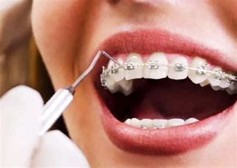 Pride Dental Clinic