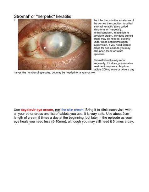 3 Herpetic keratitis-Dendritic corneal ulcers & Stromal keratitis.docx