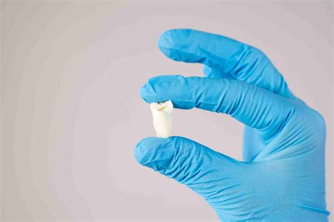 Does Everyone Have Wisdom Teeth?