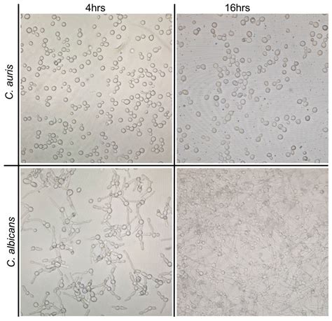 Metabolic Profiling of Candida auris, a Newly-Emerging Multi-Drug ...