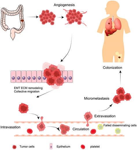 Role of Post-Translational Modifications in Colorectal Cancer Metastasis