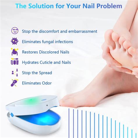 Buy Anti Fungal Treatment Laser Device Finger Toe Nail Fungus Remover ...