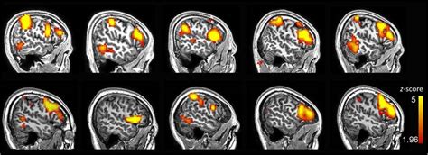 Language Mapping 的图像结果