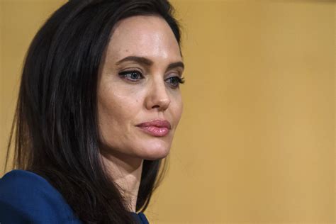What Is Bell’s Palsy? Angelina Jolie, Other Celebrities Who Suffered ...
