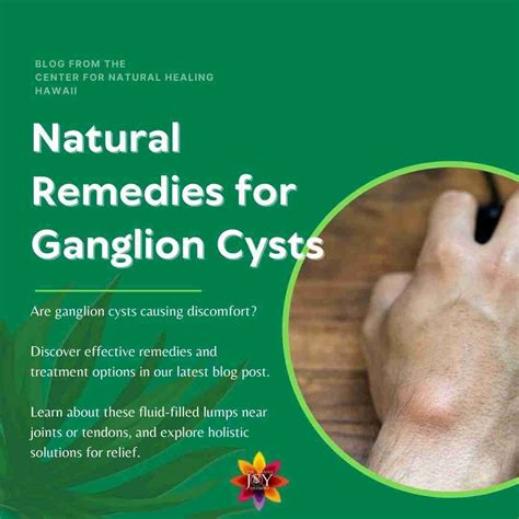 Should A Ganglion Cyst Hurt - Infoupdate.org