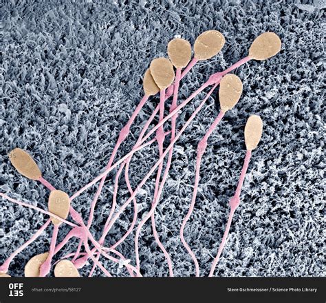 Sperm Cell Under Electron Microscope