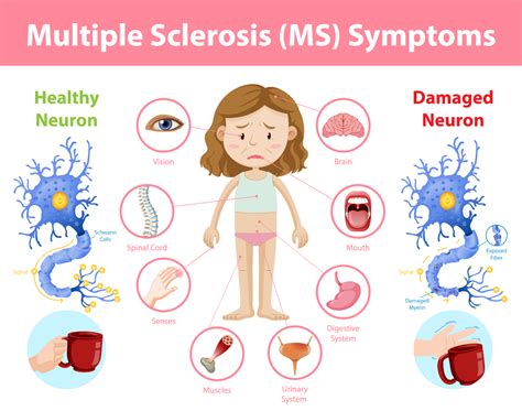 The Relationship Between Multiple Sclerosis and Anxiety
