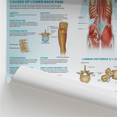The Anatomy of Lower Back Pain | Low Back Pain | AnatomyStuff - back pain chart