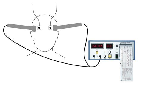 Nichtinvasive Stimulationsverfahren bei Depression - Psychiatrie ...