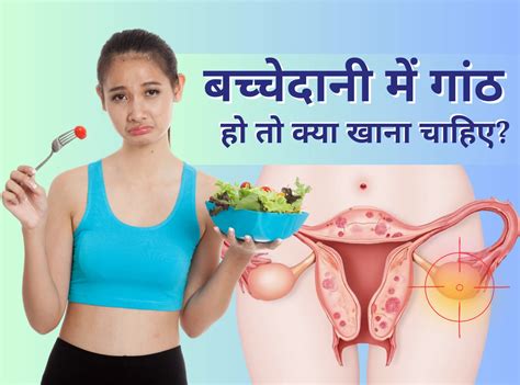 बच्चेदानी में गांठ हो तो क्या खाना चाहिए - Vinsfertility