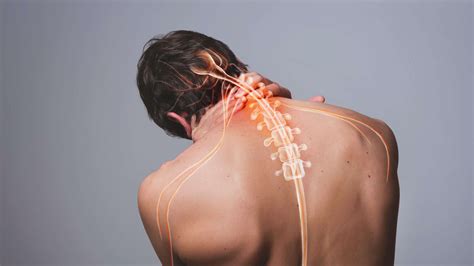 Dolor en la nuca: causas y cómo actuar - RS7
