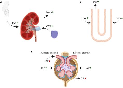 Peripheral Edema From Chf
