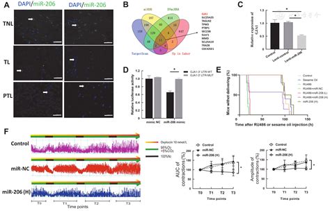 MicroRNA-206 functions as a potential oligonucleotide therapeutics in preterm birth | Chinese ...