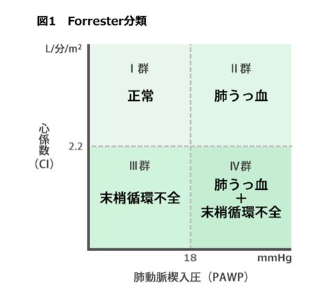 Image result for Stack Layout Display