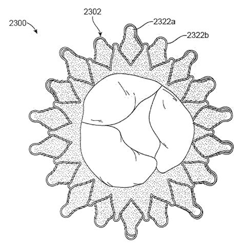 Replacement mitral valves - Eureka | Patsnap