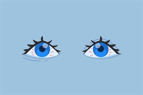 Waking Up with Dry Eyes: Causes and Treatment - Amerisleep