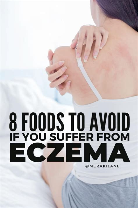 Natural eczema treatment 7 natural ways to treat eczema that work – Artofit