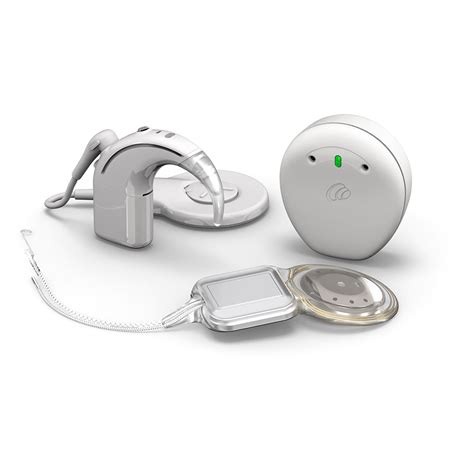 Cochlear Launches World's First and Only Smart Cochlear Implant System