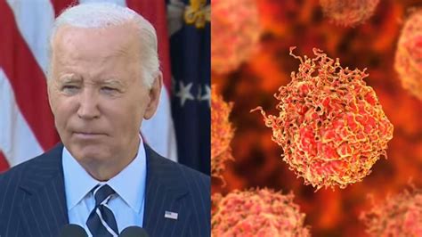 Joe Biden Prostate Cancer: अमेरिका के पूर्व राष्ट्रपति जो बाइडेन इस ...