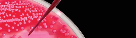 Clinical Microbiology | Infexn Laboratories