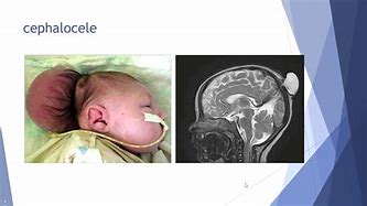 Image result for malformations