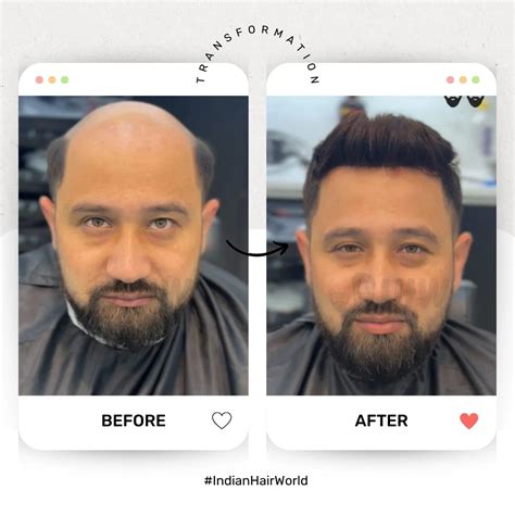 Indian Hair World - Premium Hair Solutions