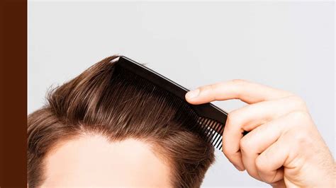 How to Salvage Your Thinning Hair | Hair Loss in Men| GQ Grooming | GQ ...