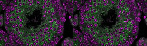 Home - INDIAN ACADEMY OF MEDICAL GENETICS(IAMG)