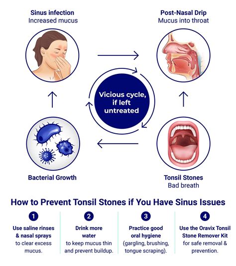 Post-Nasal Drip and Tonsil Stones: What's the Link?