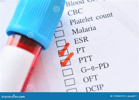 Blood Sample for PT and PTT Test Stock Image - Image of science ...