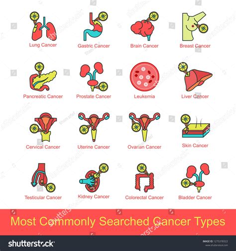 Types of Cancer Names 的图像结果