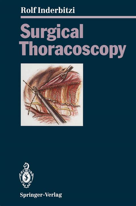 Surgical Thoracoscopy eBook : Inderbitzi, Rolf Gilbert Carl, Althaus, U ...
