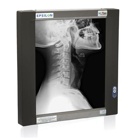 EP V01 Single Film – Epsilon Healthcare Solutions Pvt. Ltd.