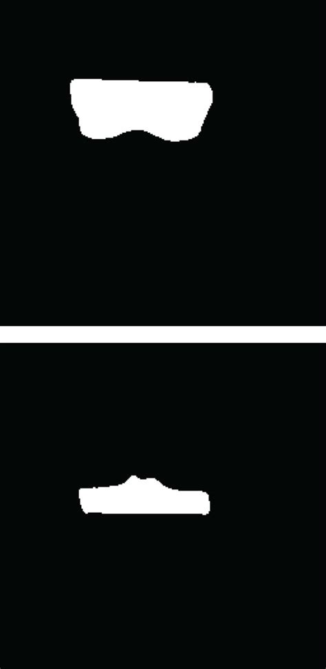 Knee Net Deep Learning Model 的图像结果