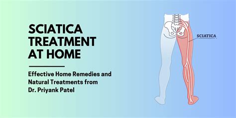 Sciatica Treatment at Home - The Spine Clinics