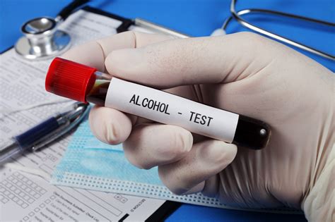 Alcohol Blood Test Results Explained at Glenn Nelsen blog