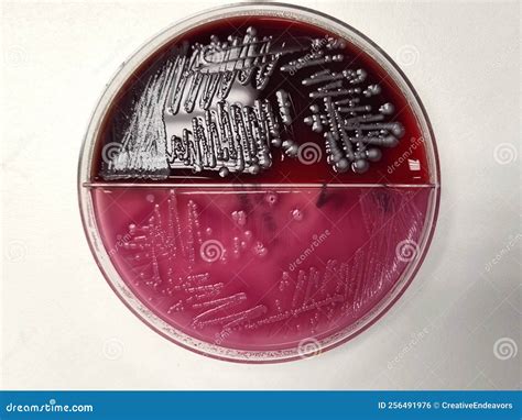 E Coli On Blood Agar