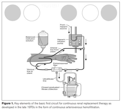CRRT Recirculation 的图像结果