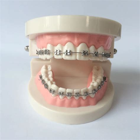 Orthodontic teeth model