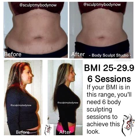 Laser Lipo Legs Before And After at Georgia Levvy blog