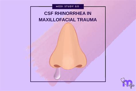 CSF Rhinorrhea in Maxillofacial Trauma: Causes, Diagnosis, and Managem ...